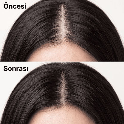 Yoracare™Saç Derisi Güçlendirici